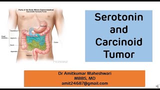 Carcinoid tumour  Serotonin Happy Hormone  Biochemistry  NEET PG [upl. by Kavita]