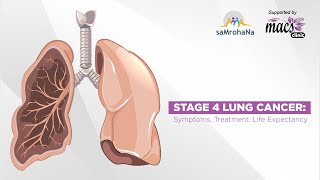 Stage 4 Lung Cancer Symptoms Treatment Life Expectancy  Episode 22 [upl. by Josias]