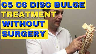 C5 C6 Disc Bulge Treatment Without Surgery  Bulging Disc C5 C6  Dr Walter Salubro [upl. by Hait58]