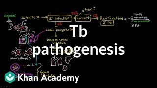 TB pathogenesis  Infectious diseases  NCLEXRN  Khan Academy [upl. by Niattirb]