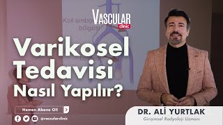 Varikosel Tedavisi Nasıl Yapılır  Girişimsel Radyoloji Uzmanı Ali Yurtlak [upl. by Christensen]