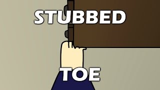 Stubbed Toe [upl. by Charron]