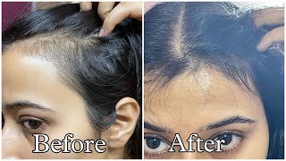 The Most Potent Hair Growth Oil😱 Do Not Wash It Out for Extreme Hair Growth [upl. by Eelsew]