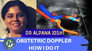 Obstetric Doppler  How I Do It  Dr Alpana Joshi  UMBILICAL ARTERY DOPPLER  MCA PI [upl. by Carrnan500]