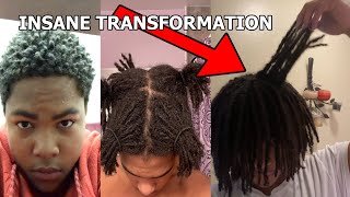 CRAZY 2 Year Semi Freeform Dreadlock Transformation 😲🔥 [upl. by Ander437]