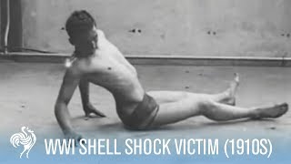 World War 1 Shell Shock Victim Recovery 1910s  War Archives [upl. by Erdman702]