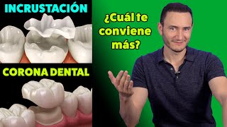 Incrustación vs Corona Dental ¿Cuál te conviene más  Cuando está indicada [upl. by Thorr]