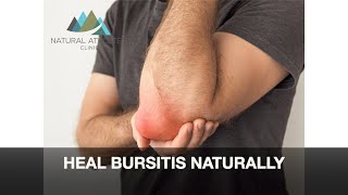 Heal Bursitis Naturally [upl. by Minor]