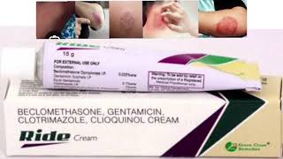 Ride Cream BECLOMETHASONE GENTAMICIN CLOTRIMAZOLE CLIOQUINOL CREAM [upl. by Nomolos59]