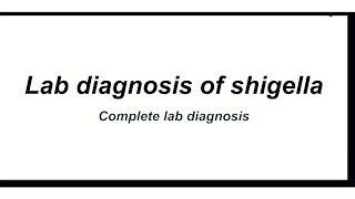 shigella lab diagnosis  lab diagnosis of shigella  shigella dysentry lab diagnosis  shigella [upl. by Herries]