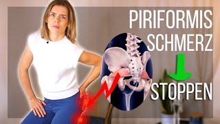 Wie du Schmerzen bei Piriformis Syndrom ANHALTEND beendest Test und Übungen [upl. by Etselec365]