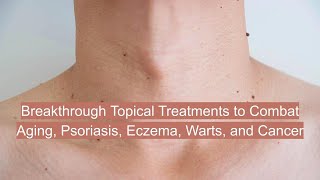 Topical Treatments for Psoriasis Eczema Warts and Aging health aging longevity inflammation [upl. by Htial948]