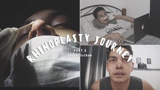 RECOVERY  1 MONTH POST OP REVEAL  MY RHINOPLASTY JOURNEY PART 2  PHILIPPINES  justkrischan [upl. by Conger]