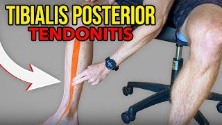 3 Exercises for Tibialis Posterior Tendonitis [upl. by Sharos]