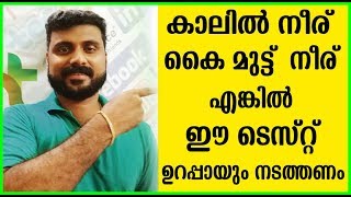 കാലിലും കയ്യിലും നീരുണ്ടോ എങ്കിൽ ഈ ടെസ്റ്റ് നടത്തണം  Home Remedies to Reduce Uric Acid Level [upl. by Hopper675]