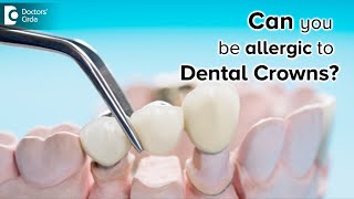 Allergy to tooth crown and bridge Symptoms Treatment  Dr Ranjani Rao  Doctors Circle [upl. by Bumgardner]