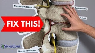 How to Fix a Bulging Disc in Your Lower Back  RELIEF IN SECONDS [upl. by Kwasi987]