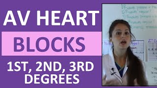 How to Interpret AV Heart Blocks Ekg Heart Rhythms  1st degree 2nd degree 3rd degree difference [upl. by Eanrahs]