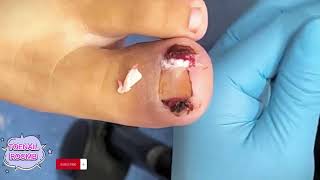 Toenail ASMR and Pedicure DIY 425 [upl. by Jami976]