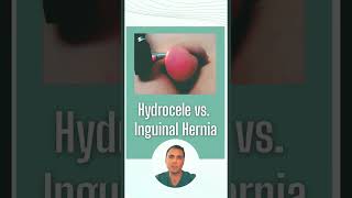 Hydrocele vs inguinal hernia [upl. by Lahpos570]