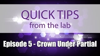 Quick Tips Episode 5  Crown Under Partial [upl. by Ahseekan342]