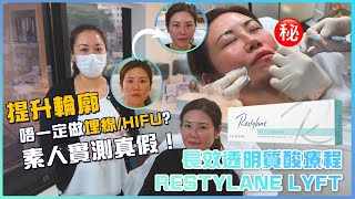 Restylane Lyft 鼻 長效透明質酸療程｜除了埋線療程，還有什麼方法可以提升鼻子或輪廓？｜為什麼推薦使用透明質酸填充劑？｜唯一真實100 素人實測！ medskinhk [upl. by Akeemat]