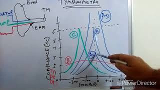 Tympanometry Impedance Audiometry [upl. by Pansir31]