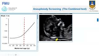 Preeclampsia and Aneuploidy Screening Updated [upl. by Wiltsey]