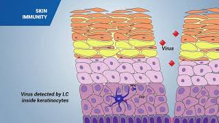 Immune response in the skin [upl. by Schear988]