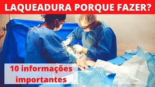 LAQUEADURA PORQUE FAZER 10 informações importantes [upl. by Llirrehs311]