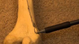 Anatomy and Osteology of the Femur [upl. by Jessa]