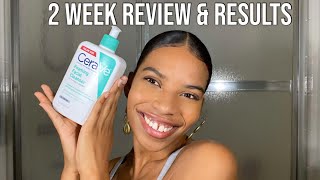 CeraVe Foaming Facial Cleanser Review  Is it worth the hype [upl. by Eitirahc]