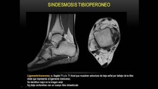 Anatomía de tobillo Resonancia M Parte 1 [upl. by Auqinihs352]