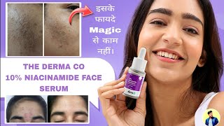 The Derma Co 10 Niacinamide Face Serum  100 Effective Solution For Acne Problem [upl. by Neibaf]