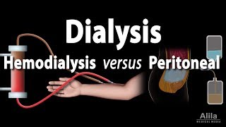 Renal Replacement Therapy Hemodialysis vs Peritoneal Dialysis Animation [upl. by Neil531]