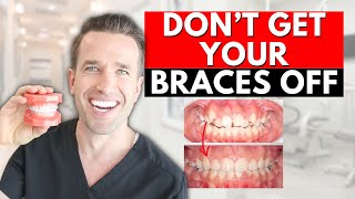 Braces Off How to know if youre DONE WITH BRACES [upl. by Morgana]