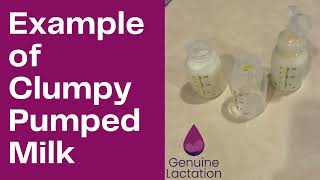 Clumpy Pumped Milk Confirmed Breast Infection [upl. by Lyrehc]