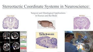 Stereotactic Coordinate Systems in Neuroscience and Medicine Applications in Rat and Human Brain [upl. by Paulina321]