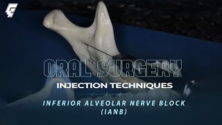 injection techniques 2  inferior alveolar nerve block  oral surgery  عزت شومان [upl. by Nollad]