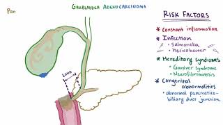 Gallbladder cancer adenocarcinoma causes symptoms amp pathology [upl. by Ikairik]