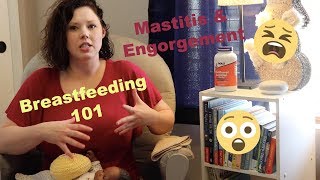 Mastitis and Engorgement  Lactation Consultant  Nurse Whit [upl. by Nezah443]