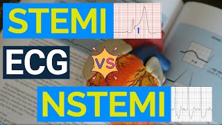 Decoding ECG Changes STEMI vs NSTEMI  A Comprehensive Guide to Heart Attack Diagnosis [upl. by Adil]