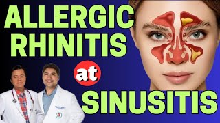 Allergic Rhinitis at Sinusitis  Payo ni Doc Gim Dimaguila ENT Doctor at Doc Willie Ong [upl. by Rabin450]