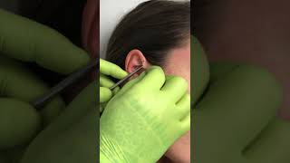 Anti helix piercing [upl. by Camarata845]