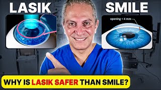 Should you Choose LASIK or SMILE Eye Surgery Eye Surgeon Explains [upl. by Grigson]