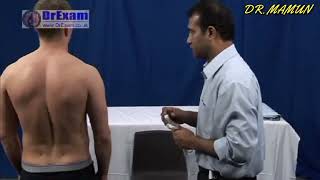 SPINE EXAMINATION MRCS OSCE DREXAM [upl. by Jelene]