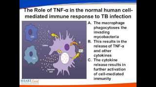 Management of Tuberculosis in Patients on TNF alpha Inhibitors [upl. by Seely]