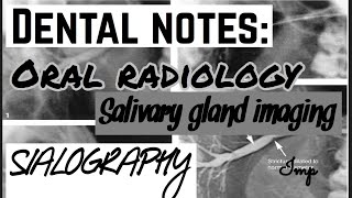 SIALOGRAPHY  SALIVARY GLAND IMAGING  ORAL RADIOLOGY  DENTAL NOTES [upl. by Garneau]