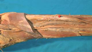 Arcus tendineus musculi solei canalis musculofibularis HD [upl. by Issac511]