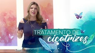 O melhor tratamento para cicatrizes Laser ou Microagulhamento [upl. by Aiuqes770]